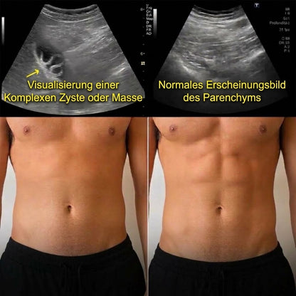 Rizinusöl-Darmwickel Set -Heilogen™
