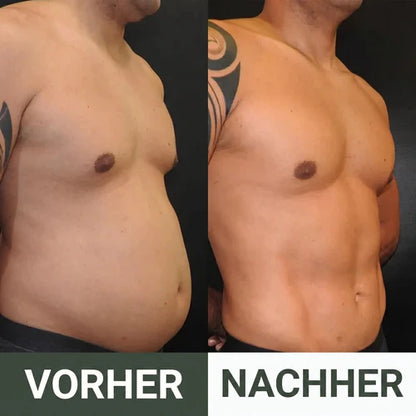 Entgiftungspackung mit Rizinusöl -Heilogen™