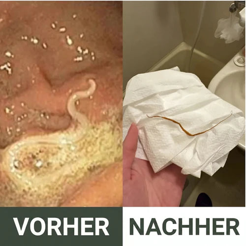 Entgiftungspackung mit Rizinusöl -Heilogen™