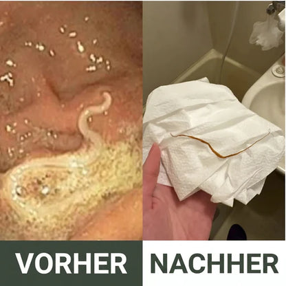 Entgiftungspackung mit Rizinusöl -Heilogen™